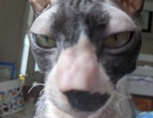 how can i prevent pavatalgia disease