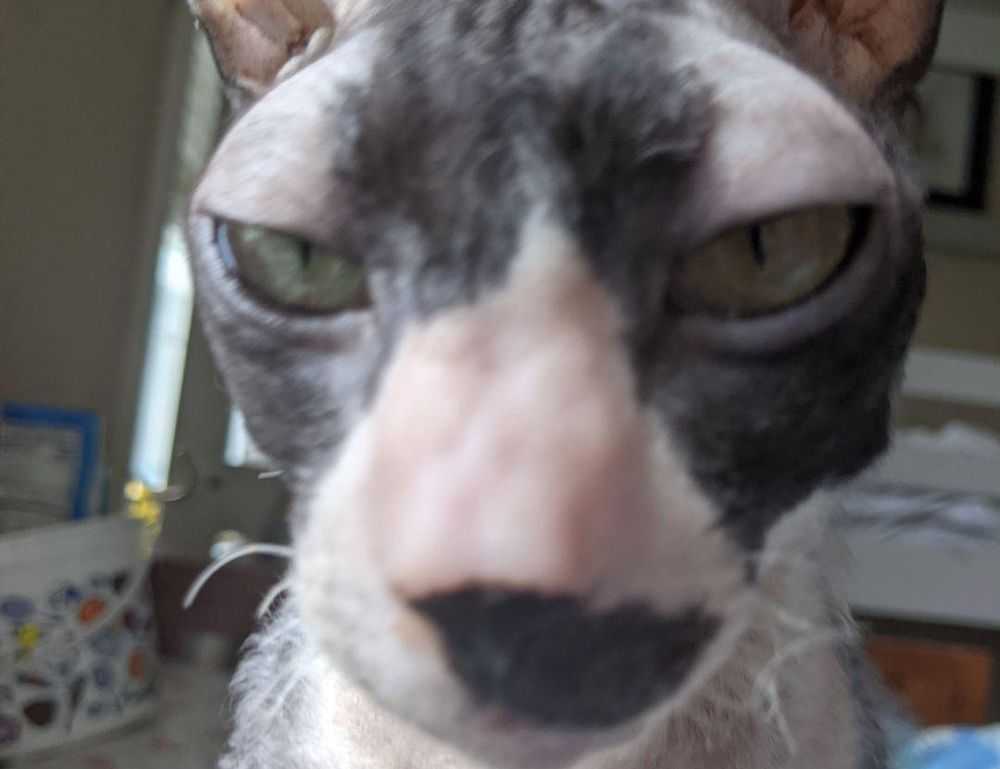 how can i prevent pavatalgia disease